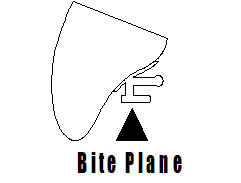 bite plane effect